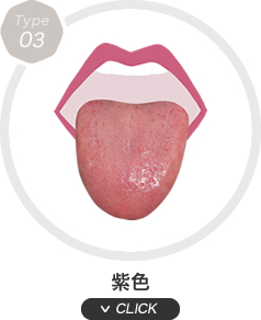紫色