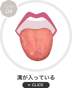溝が入っている