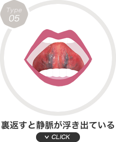 裏返すと静脈が浮き出ている