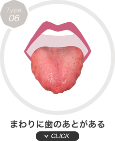 まわりに歯のあとがある
